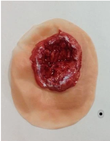 Xtreme Electrical Burn Palm