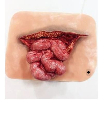 Intestino Eviserado Xtreme